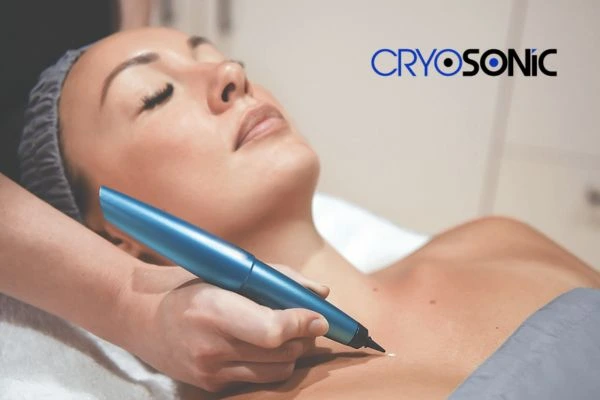 Cryosonic lesion removal prices book today! Hythe