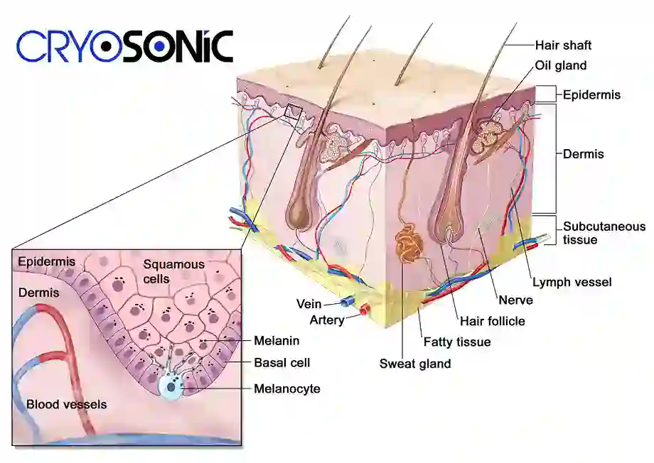 How Cryotherapy Stimulates Melanocyte Activity  Hythe